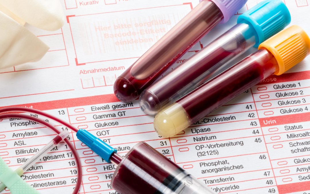 WHEN ROUTINE BLOOD TESTS DO MORE HARM THAN GOOD…