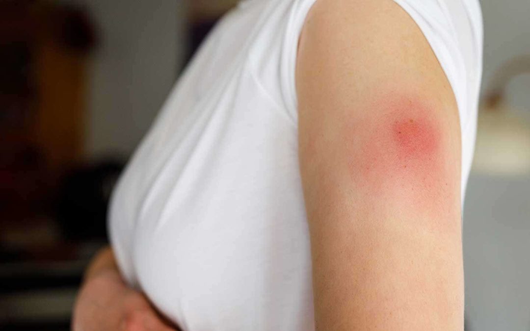 FROM SORE ARMS TO SUDDEN DEATH: READER REPORTS ON ADVERSE COVID VAX REACTIONS