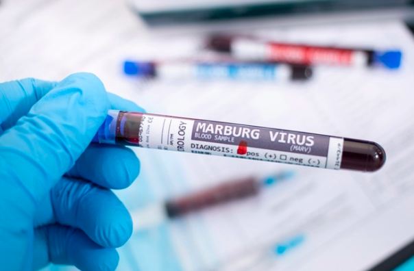 MARBURG: TIME TO PREPARE FOR ANOTHER FAKE PANDEMIC?