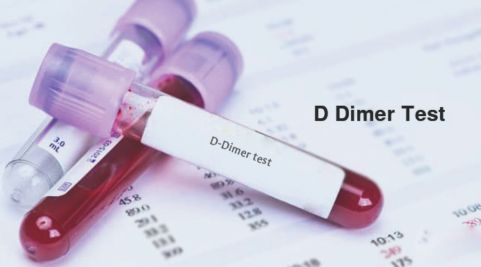 VAXED? REQUEST YOUR D-DIMER BLOOD TEST NOW!