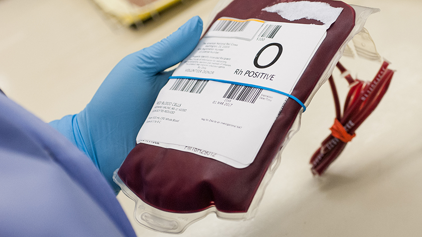 IS OUR AUSTRALIAN BLOOD SUPPLY EQUALLY CONTAMINATED?